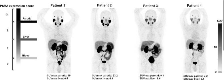 https://cdn.ncbi.nlm.nih.gov/pmc/blobs/cda5/7048889/c9fd5c6d195e/13550_2020_596_Fig4_HTML.jpg
