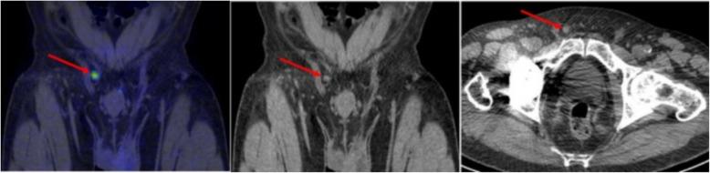 https://cdn.ncbi.nlm.nih.gov/pmc/blobs/cda5/7048889/dcd0bdbb19f6/13550_2020_596_Fig2_HTML.jpg