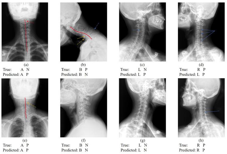 https://cdn.ncbi.nlm.nih.gov/pmc/blobs/cda9/11174662/5cc3d811cf9d/sensors-24-03428-g006.jpg