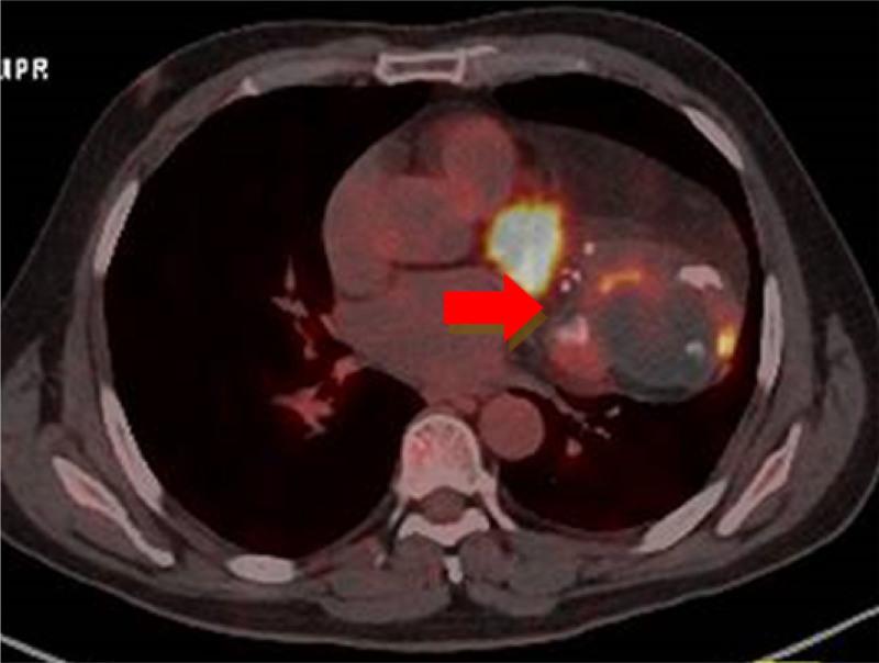 https://cdn.ncbi.nlm.nih.gov/pmc/blobs/cdac/11630991/b419e231471b/medi-103-e40748-g002.jpg