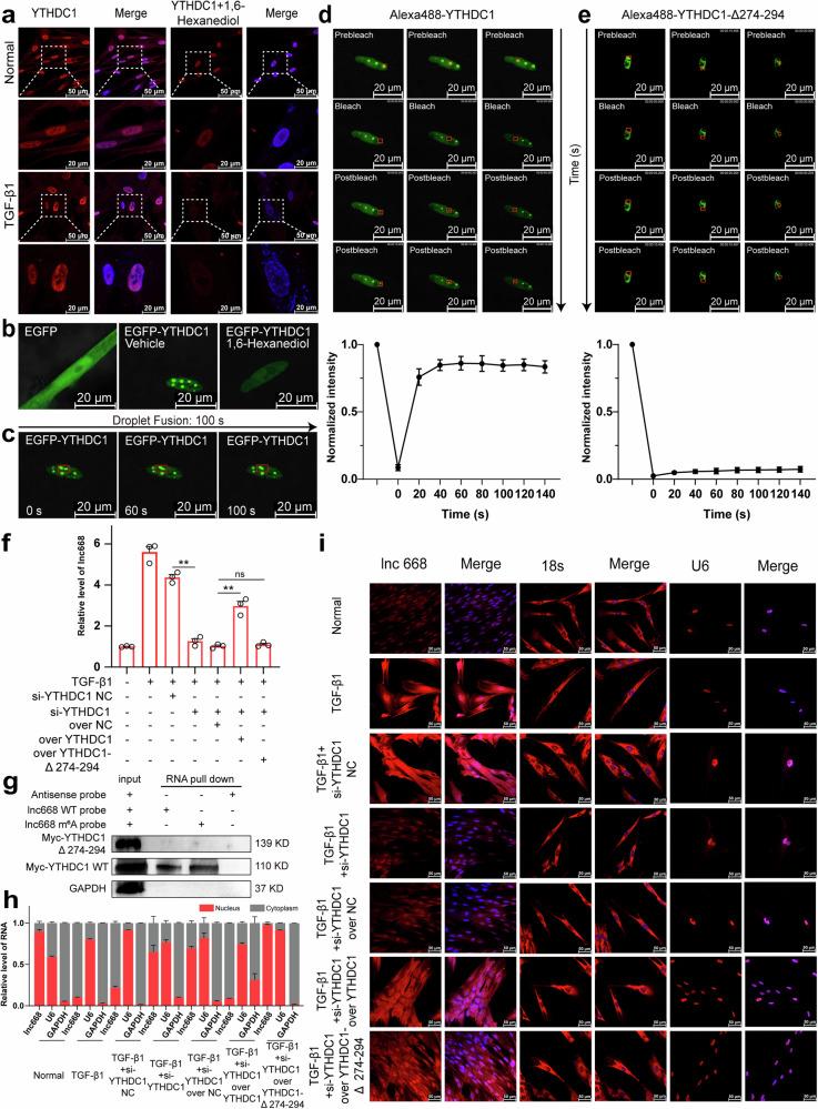 https://cdn.ncbi.nlm.nih.gov/pmc/blobs/cdae/11993731/c038a9557405/41419_2025_7608_Fig4_HTML.jpg