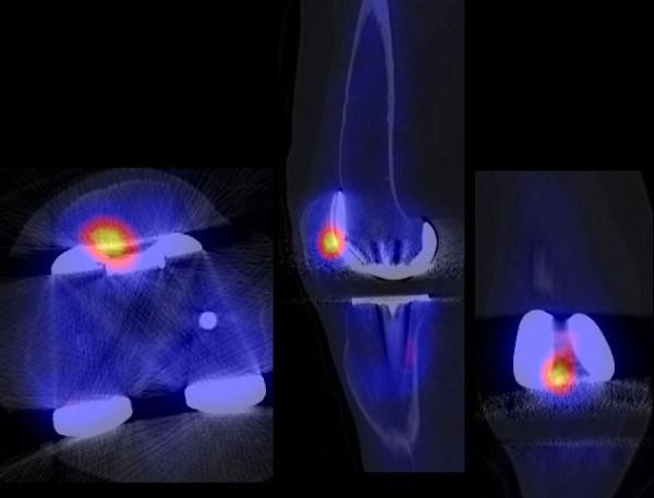 https://cdn.ncbi.nlm.nih.gov/pmc/blobs/cdb7/3040164/e921dfdd69e3/1471-2474-12-36-2.jpg