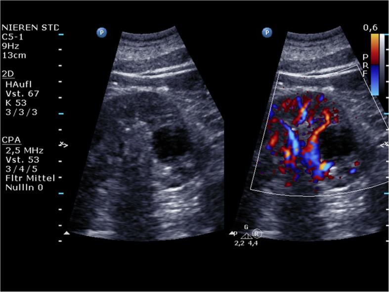 https://cdn.ncbi.nlm.nih.gov/pmc/blobs/cdbc/6746898/35aefbef90f0/13244_2019_775_Fig1_HTML.jpg