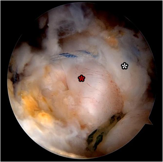 https://cdn.ncbi.nlm.nih.gov/pmc/blobs/cdbf/12276545/3997f228f929/gr3.jpg