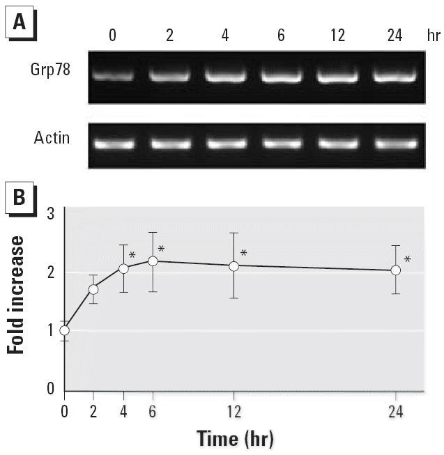 https://cdn.ncbi.nlm.nih.gov/pmc/blobs/cdc1/1480533/fcb19167bc77/ehp0114-000859f2.jpg