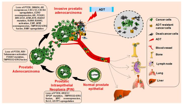 https://cdn.ncbi.nlm.nih.gov/pmc/blobs/cdc7/7563251/d099513bdcd1/cancers-12-02651-g002.jpg