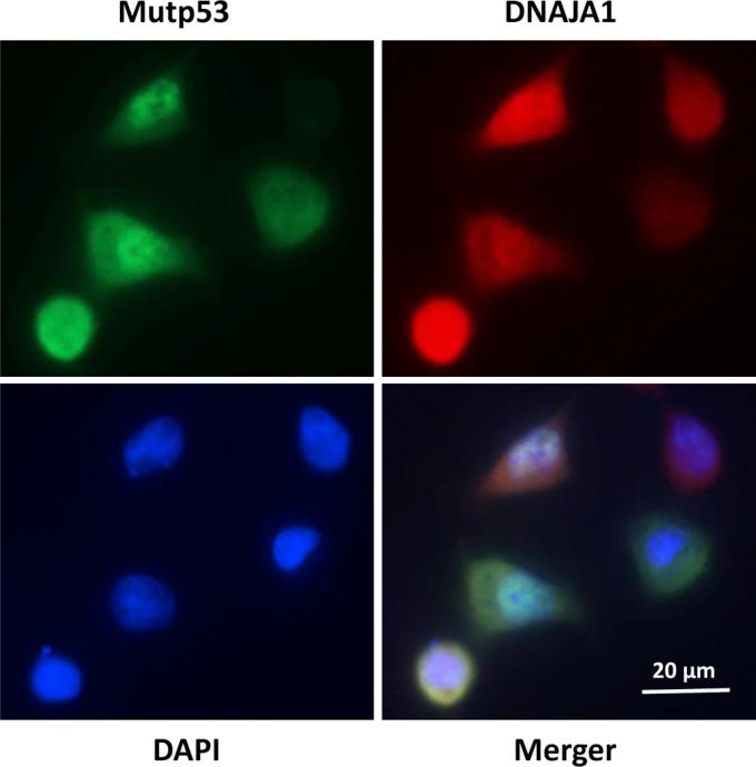 https://cdn.ncbi.nlm.nih.gov/pmc/blobs/cdc7/7948449/c13648869978/gr3.jpg