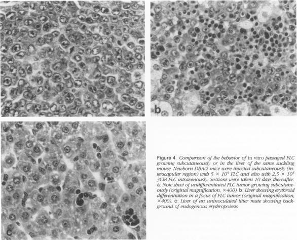 https://cdn.ncbi.nlm.nih.gov/pmc/blobs/cdc8/1886033/09985dac2ee6/amjpathol00101-0073-a.jpg