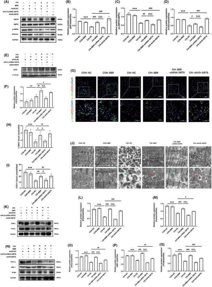 https://cdn.ncbi.nlm.nih.gov/pmc/blobs/cdcb/11187832/e7da582acd5a/JCMM-28-e18407-g001.jpg