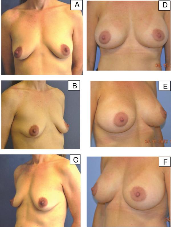 https://cdn.ncbi.nlm.nih.gov/pmc/blobs/cdcf/3917530/8c155c6fd9c1/1752-1947-7-275-2.jpg