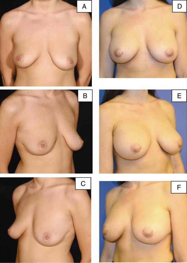 https://cdn.ncbi.nlm.nih.gov/pmc/blobs/cdcf/3917530/c3b275b650e8/1752-1947-7-275-4.jpg