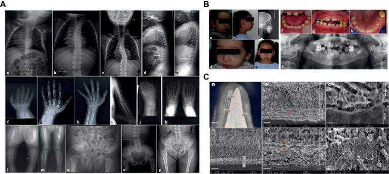 https://cdn.ncbi.nlm.nih.gov/pmc/blobs/cdd6/6546871/00caacfaf8e4/fgene-10-00504-g001.jpg