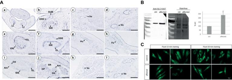https://cdn.ncbi.nlm.nih.gov/pmc/blobs/cdd6/6546871/ad83e47932d0/fgene-10-00504-g003.jpg