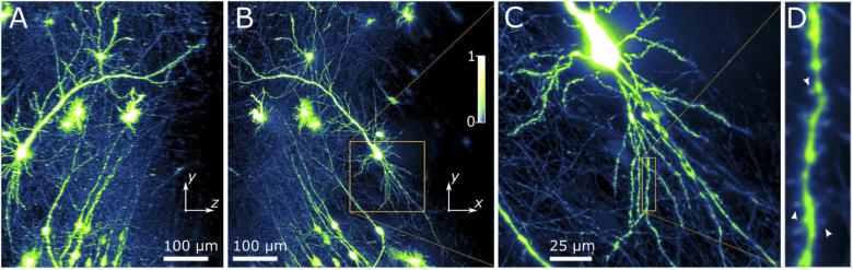 https://cdn.ncbi.nlm.nih.gov/pmc/blobs/cddb/7510906/38076d97f270/boe-11-7-3927-g003.jpg