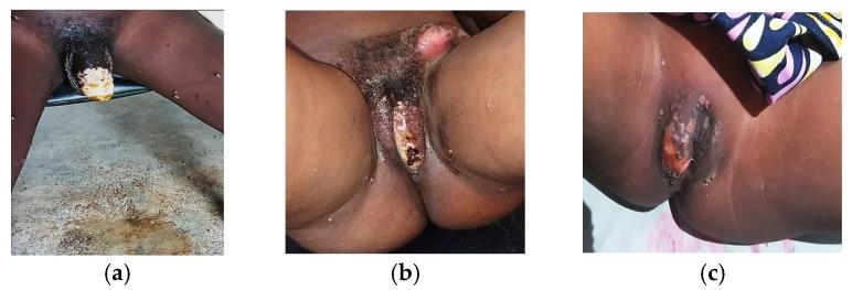 https://cdn.ncbi.nlm.nih.gov/pmc/blobs/cddf/12030875/948787e1f05c/viruses-17-00480-g003.jpg