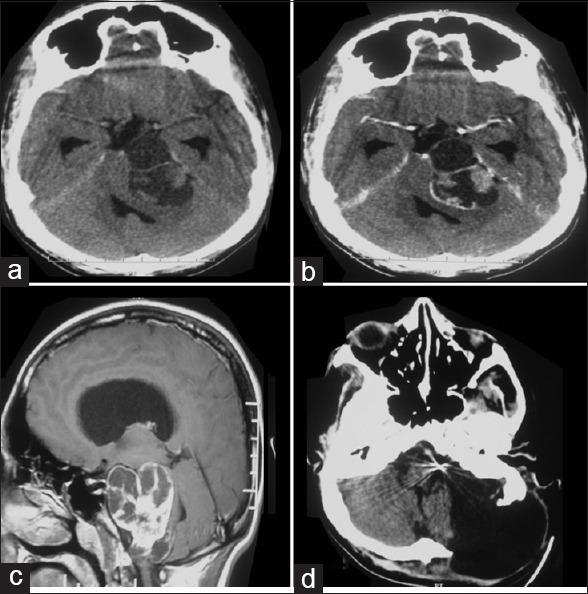 https://cdn.ncbi.nlm.nih.gov/pmc/blobs/cde3/4849290/877193972329/AJNS-11-219-g007.jpg
