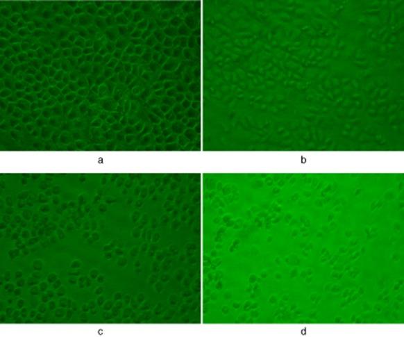 https://cdn.ncbi.nlm.nih.gov/pmc/blobs/cde4/4448485/39e19fcd2415/tca0006-0202-f1.jpg