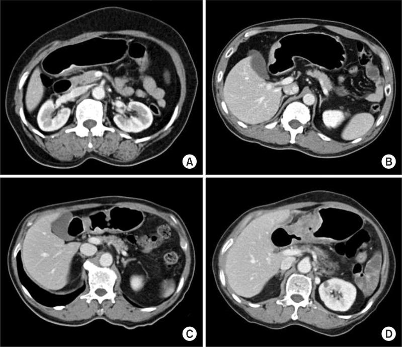https://cdn.ncbi.nlm.nih.gov/pmc/blobs/cde5/3543972/52d581d1cdbf/jgc-12-223-g002.jpg