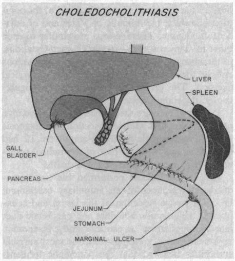 https://cdn.ncbi.nlm.nih.gov/pmc/blobs/cde8/1516294/4f7505b8ec64/califmed00060-0019-a.jpg