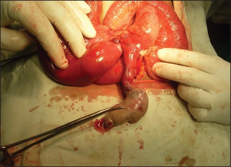 https://cdn.ncbi.nlm.nih.gov/pmc/blobs/cdec/3122099/c3a736dc567a/SJG-17-222b-g001.jpg