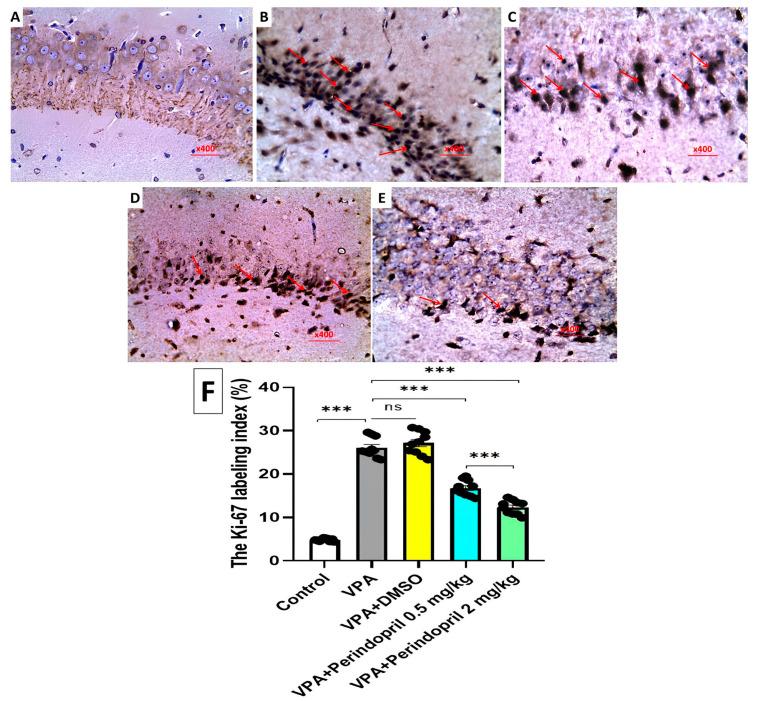 https://cdn.ncbi.nlm.nih.gov/pmc/blobs/cded/11596946/1def5df021c6/medicina-60-01802-g015.jpg