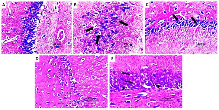 https://cdn.ncbi.nlm.nih.gov/pmc/blobs/cded/11596946/5f0824f87d36/medicina-60-01802-g014.jpg