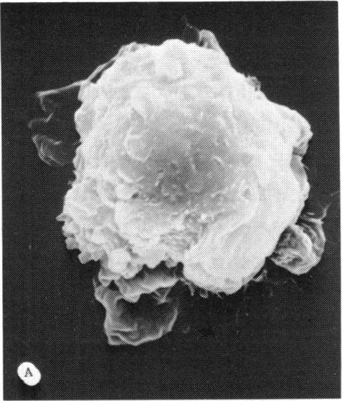 https://cdn.ncbi.nlm.nih.gov/pmc/blobs/cdee/1298601/3ad55077c421/taos00011-0592-a.jpg