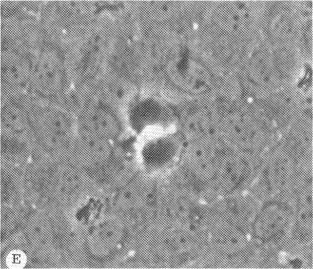https://cdn.ncbi.nlm.nih.gov/pmc/blobs/cdee/1298601/50c17d27ef7f/taos00011-0597-e.jpg