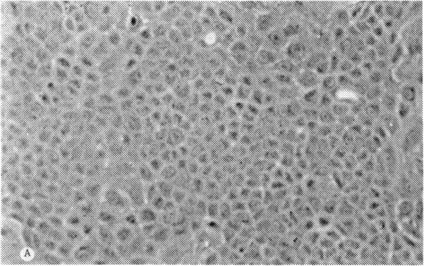 https://cdn.ncbi.nlm.nih.gov/pmc/blobs/cdee/1298601/773b6a182361/taos00011-0616-a.jpg