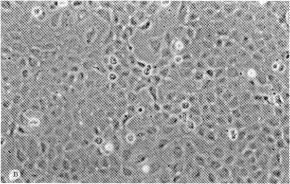 https://cdn.ncbi.nlm.nih.gov/pmc/blobs/cdee/1298601/ab4a81efa001/taos00011-0616-b.jpg