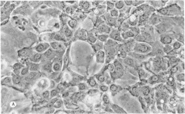 https://cdn.ncbi.nlm.nih.gov/pmc/blobs/cdee/1298601/ca4953bb00ee/taos00011-0630-a.jpg