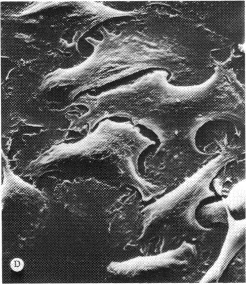 https://cdn.ncbi.nlm.nih.gov/pmc/blobs/cdee/1298601/da42f41958f2/taos00011-0592-d.jpg