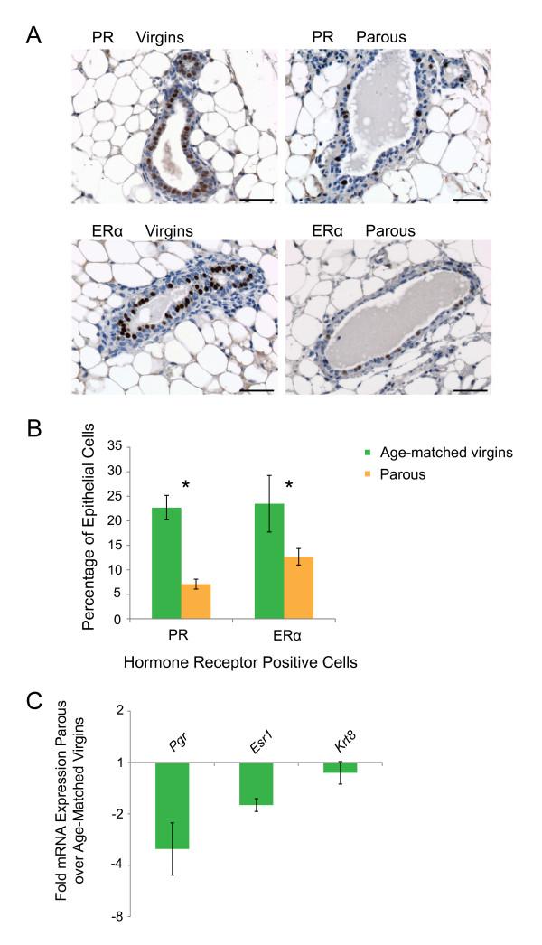 https://cdn.ncbi.nlm.nih.gov/pmc/blobs/cdfa/3672662/35f1cb3535cb/bcr3419-6.jpg