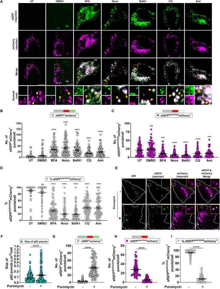 https://cdn.ncbi.nlm.nih.gov/pmc/blobs/ce00/11321044/afbd5cf296f9/mbc-35-mr6-g004.jpg