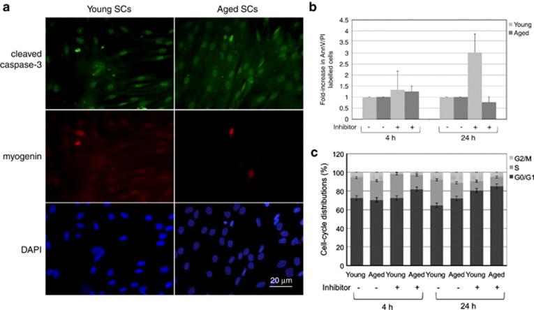 https://cdn.ncbi.nlm.nih.gov/pmc/blobs/ce02/3877545/94af89c13428/cddis2013472f5.jpg