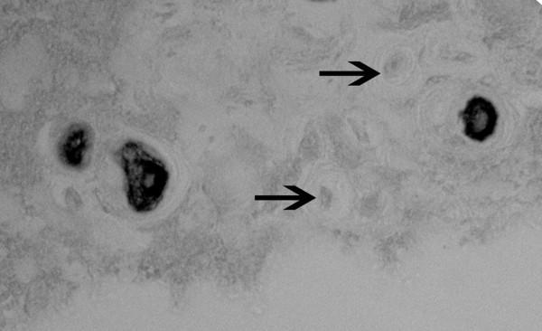 https://cdn.ncbi.nlm.nih.gov/pmc/blobs/ce0c/2688197/e6d9542122b0/ar2660-3.jpg