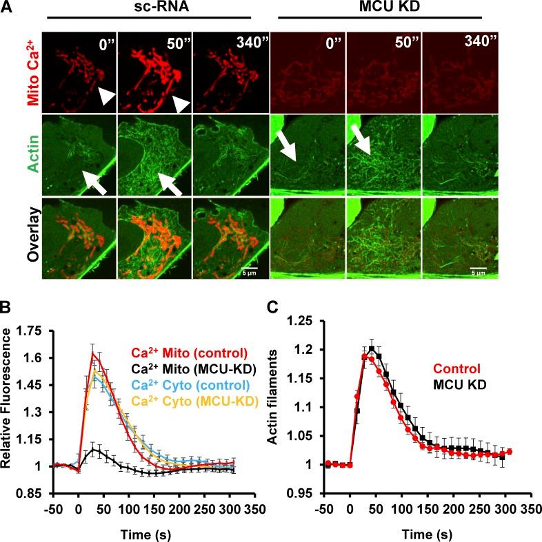 https://cdn.ncbi.nlm.nih.gov/pmc/blobs/ce0f/5748994/691334e050c0/JCB_201709111_Fig5.jpg