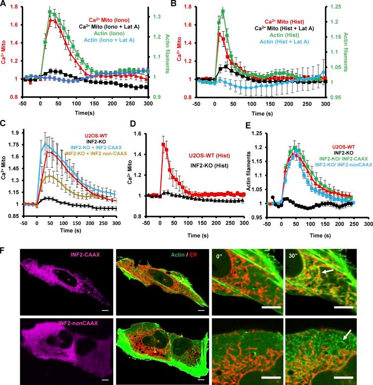 https://cdn.ncbi.nlm.nih.gov/pmc/blobs/ce0f/5748994/ecd7603bf9b6/JCB_201709111_Fig3.jpg