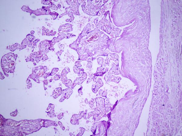 https://cdn.ncbi.nlm.nih.gov/pmc/blobs/ce1e/2640409/deca8e7f4c53/1752-1947-3-38-1.jpg