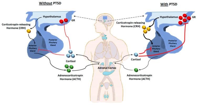 https://cdn.ncbi.nlm.nih.gov/pmc/blobs/ce1f/11911301/b4117ee4fbcf/cureus-0017-00000079022-i02.jpg