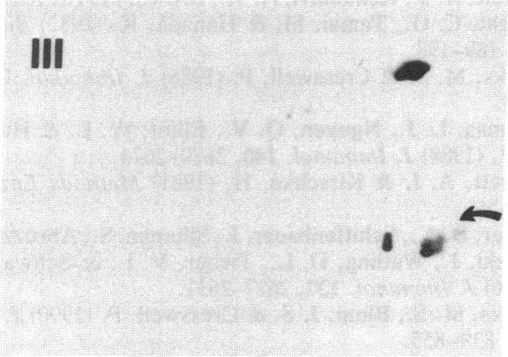 https://cdn.ncbi.nlm.nih.gov/pmc/blobs/ce20/51403/b42dfbc9220a/pnas01058-0195-e.jpg
