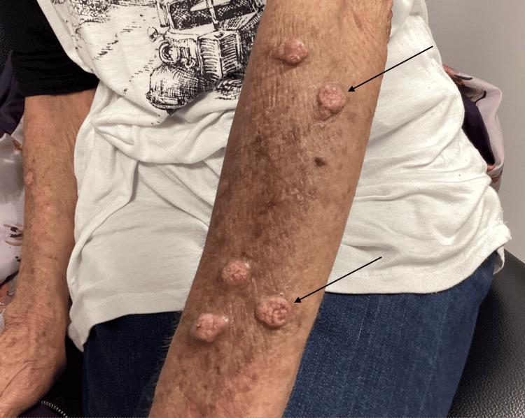 https://cdn.ncbi.nlm.nih.gov/pmc/blobs/ce2b/11338647/7db18b8f5c16/cureus-0016-00000065125-i01.jpg