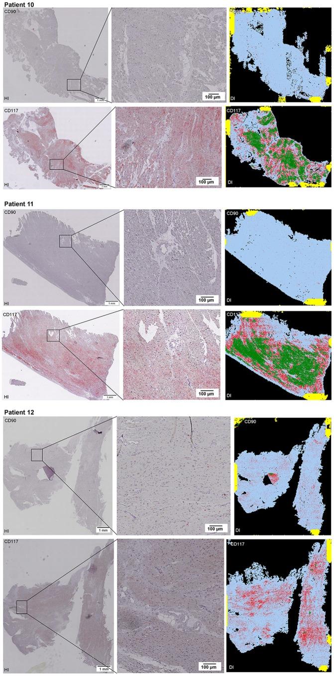 https://cdn.ncbi.nlm.nih.gov/pmc/blobs/ce2f/5845648/07163f41cbcb/fgene-09-00072-g0005.jpg