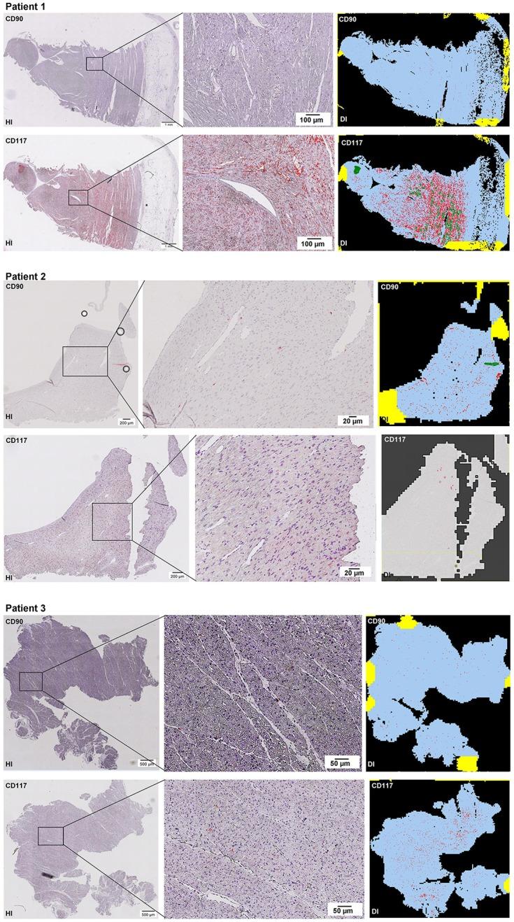 https://cdn.ncbi.nlm.nih.gov/pmc/blobs/ce2f/5845648/e4b4b36719d3/fgene-09-00072-g0002.jpg
