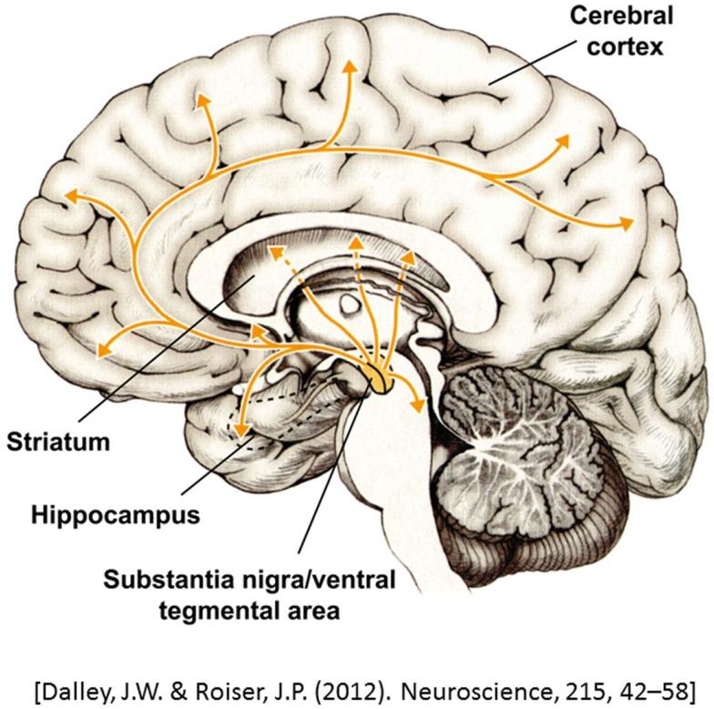 https://cdn.ncbi.nlm.nih.gov/pmc/blobs/ce31/4357260/663bf11aa9c1/fneur-06-00052-g001.jpg