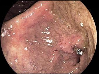 https://cdn.ncbi.nlm.nih.gov/pmc/blobs/ce35/4392180/46353f3269f4/gr5.jpg