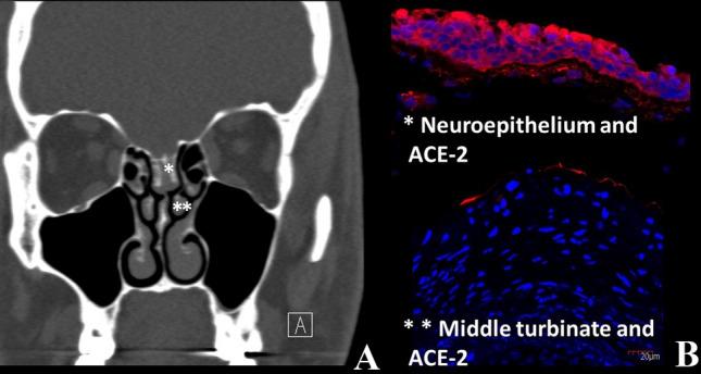 https://cdn.ncbi.nlm.nih.gov/pmc/blobs/ce38/7480210/f60c39a2bb98/405_2020_6285_Fig1_HTML.jpg