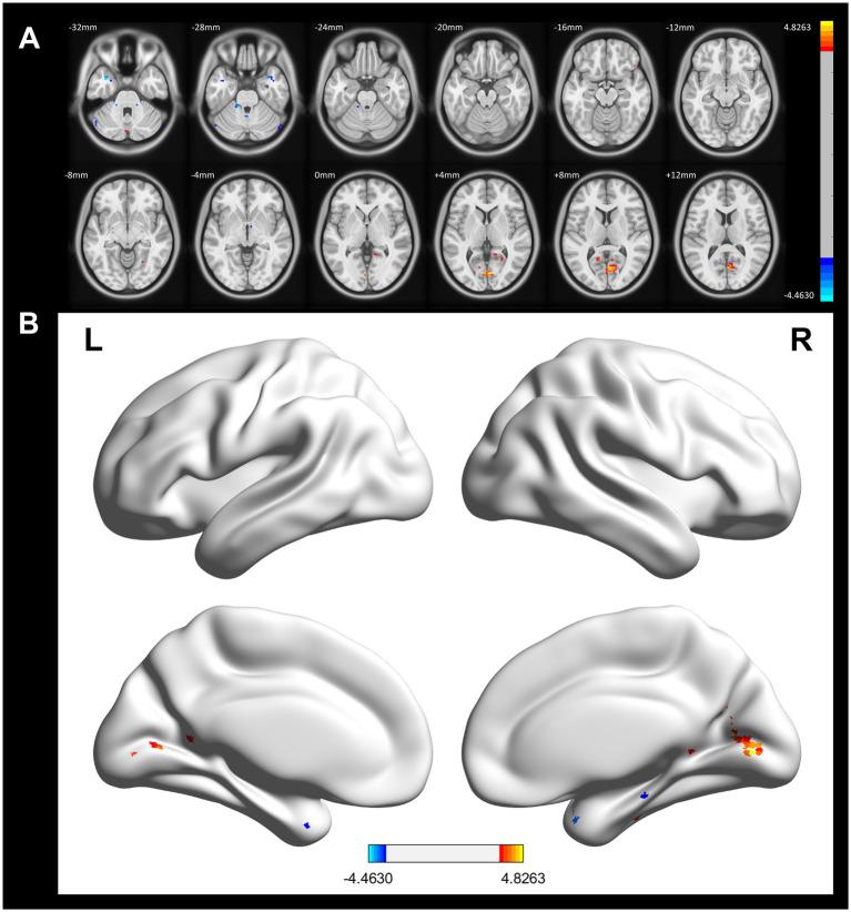 https://cdn.ncbi.nlm.nih.gov/pmc/blobs/ce55/12206823/5c4a21ba5eea/fnins-19-1610657-g003.jpg