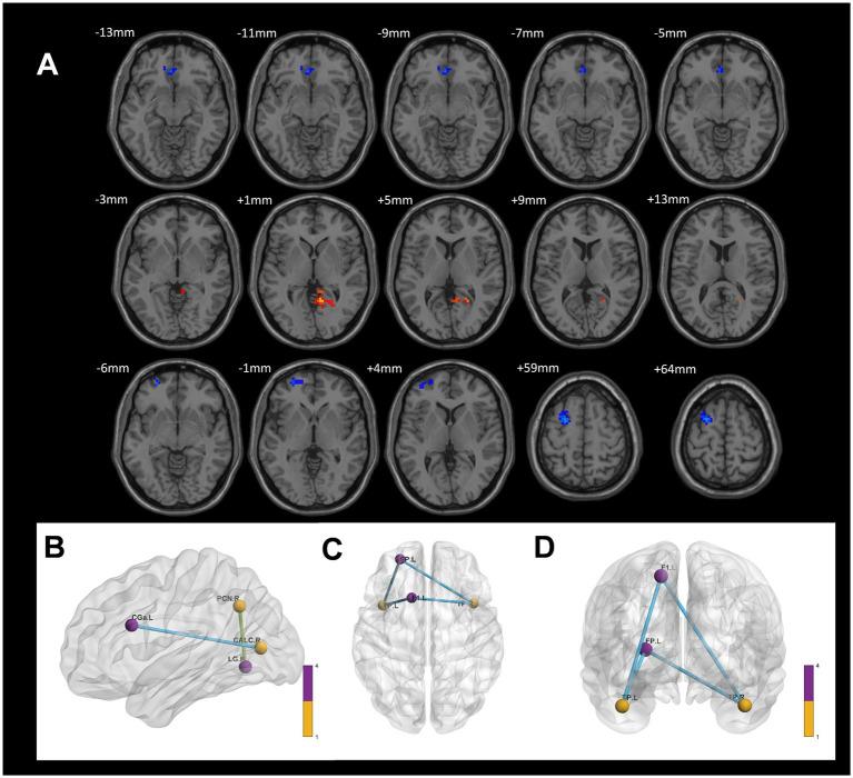 https://cdn.ncbi.nlm.nih.gov/pmc/blobs/ce55/12206823/8909ec281694/fnins-19-1610657-g007.jpg