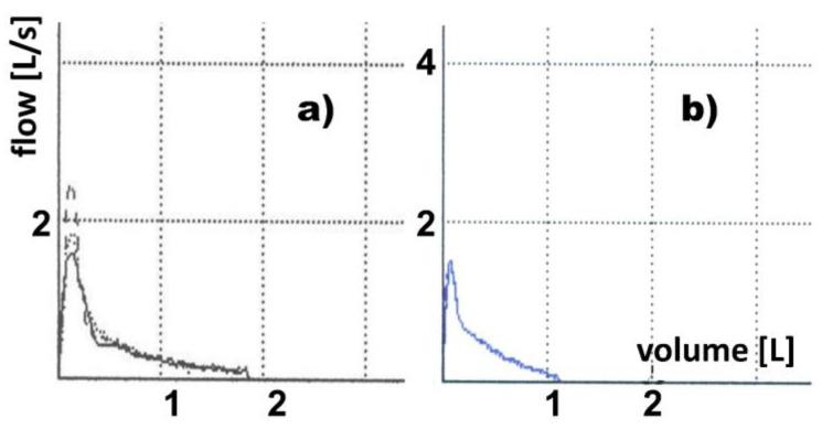 https://cdn.ncbi.nlm.nih.gov/pmc/blobs/ce5a/9227245/dc9b4daea258/membranes-12-00548-g0A3.jpg